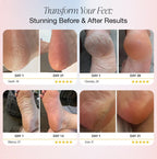 VÉLLIZ ™ SoftSole Pro +