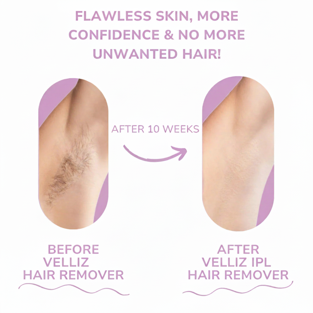 Before & After Velliz IPL – Both Updated