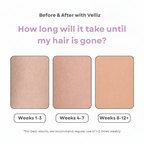 Before & After with Velliz – No Arrows