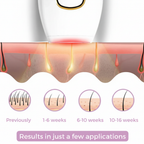 IPL Follicle Diagram – No Arrows