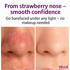 VELLIZ ClearPore™ Before After - Purple